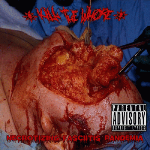 Kill The Whore : Necrotizing Fasciitis Pandemia